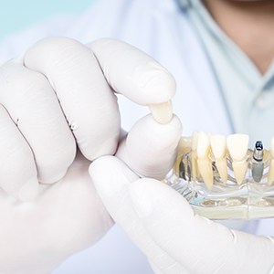 a crown being placed on a model dental implant
