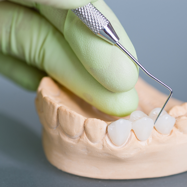 Close-up of gloved hand using dental instrument on a model of teeth